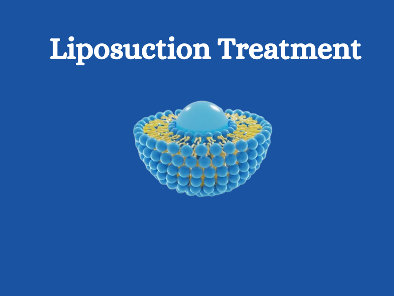 Liposuction Treatment Hospital