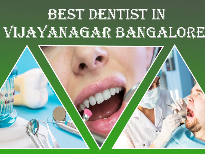 Best Dentist in Vijayanagar Bangalore | Famous & Top Dentist