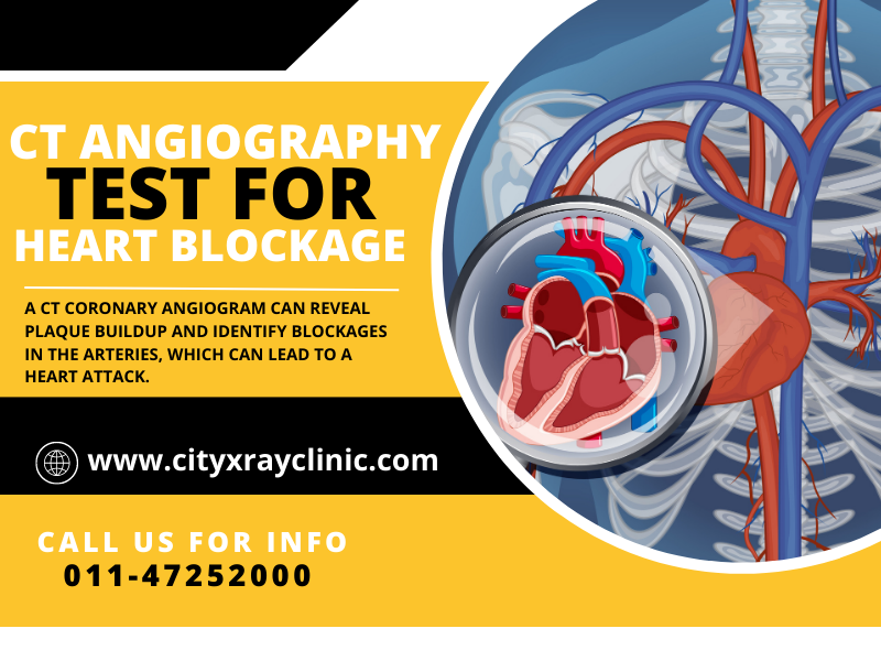Best & Reasonable Diagnostic Centre For CT Coronary Angiography Scan Near me In Delhi