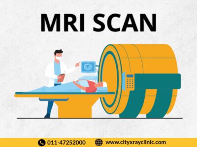Best Diagnostic Centre For MRI Scan Near Me In Delhi At Affordable Price
