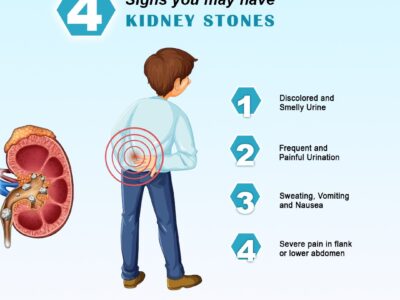Understanding the Signs You May Have Kidney Stones