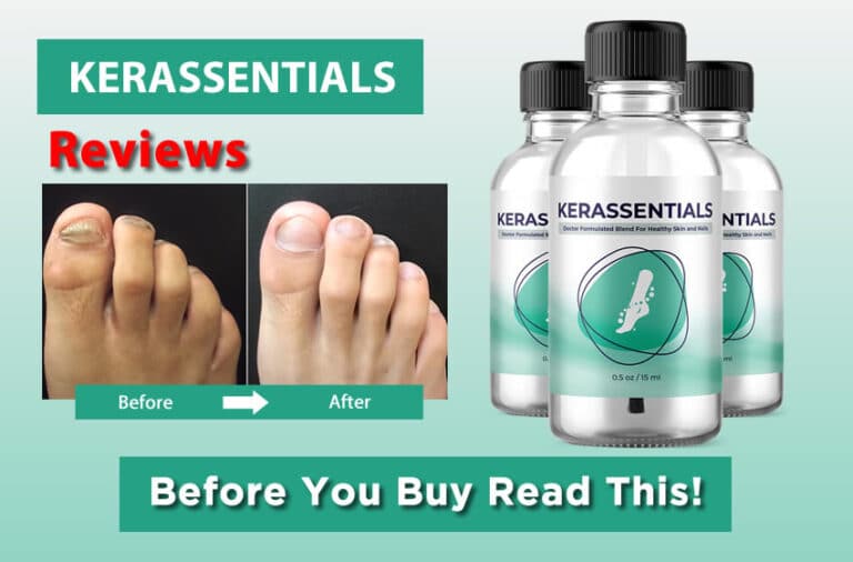 Kerassentials : Insider Information They Won't Tell You!