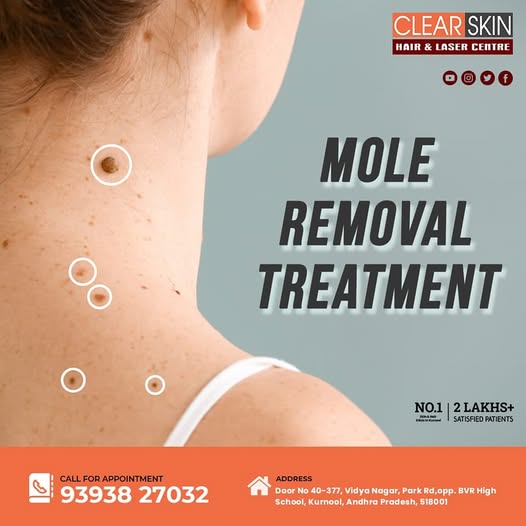 Best Advanced Acne Laser Treatment in India