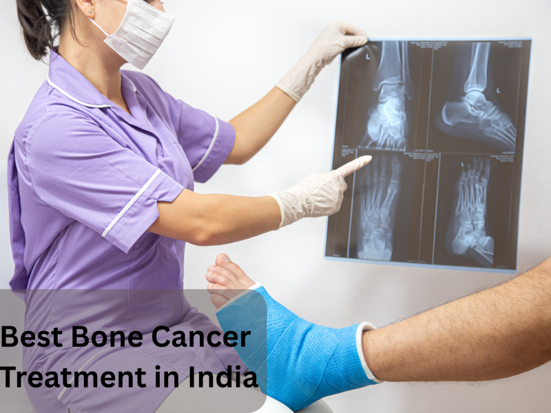 Best Bone Cancer Treatment in India – Medicover Hospital