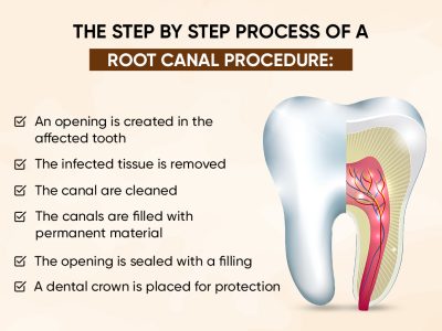 Best RCT Clinic in Indirapuram