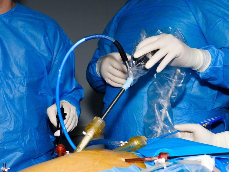 Advanced Laparoscopy Training