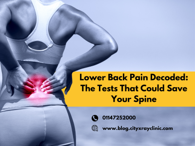 Causes of Lower Back Pain: Common Reasons, Symptoms & Diagnosis Tests