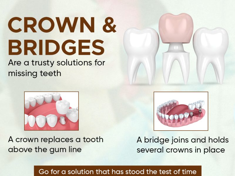 Best Dental Clinic for Tooth Cap Indirapuram