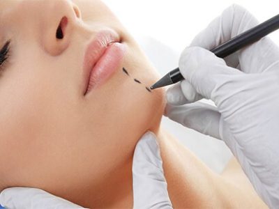 Chin augmentation surgery cost in Delhi - Dr Rajat Gupta