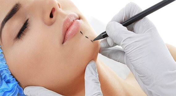 Chin augmentation surgery cost in Delhi - Dr Rajat Gupta