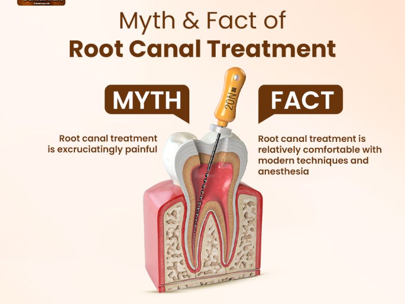 Best RCT Clinic in Indirapuram