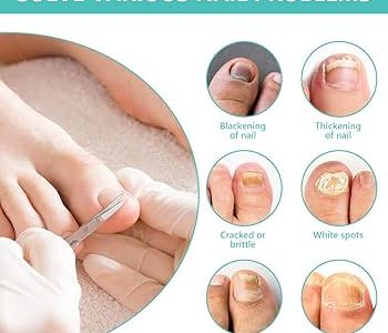 Orivelle Anti Fungus Nail Care Pen:(REAL TRUTH EXPOSED!)Is Orivelle Nail Fungus Pen Legit? Real Reviews, Complaints & Shocking Consumer Reports!!