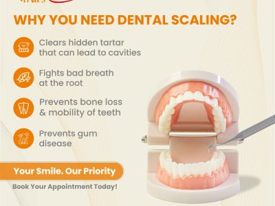 Bring Back Your Natural Shine: Professional Dental Scaling and Polishing in Mulund