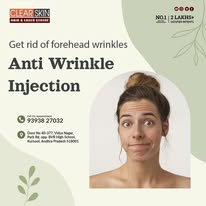 portwine stain treatment in india