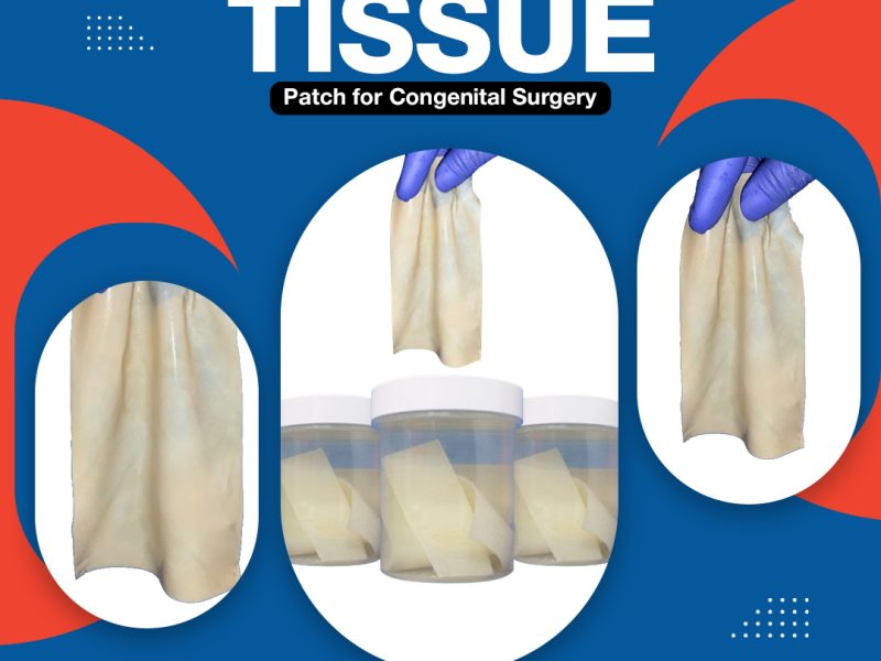Bovine Pericardial Tissue Patch for congenital surgery