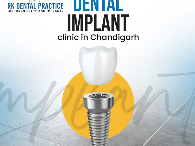Dental implant clinic in Chandigarh offering advanced tooth care