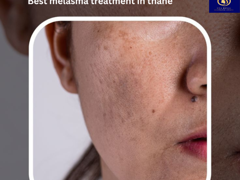 Advanced Laser Toning Facial Treatment in Thane | Trusted by DNA Royal.