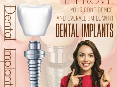 Best Dental Implant Doctor in Indirapuram