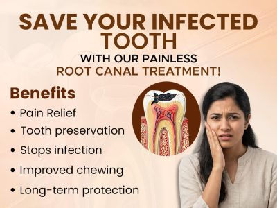 RCT clinic in Indirapuram offering precise root canal care