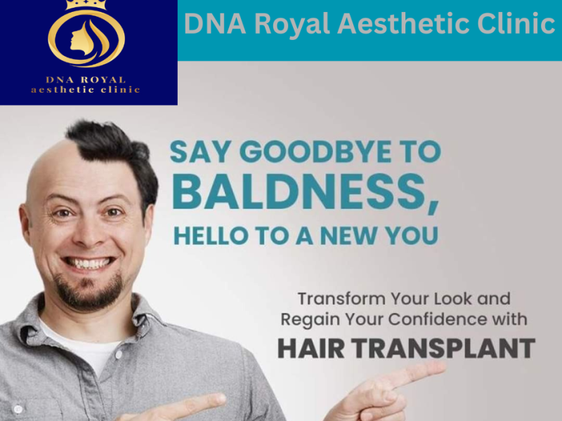 Best & No.1 Hair Transplant Clinic in Thane – DNA Royal.