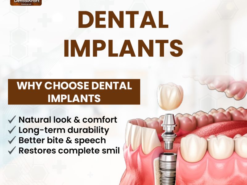Dental Implant Doctor in Indirapuram for Safe Tooth Replacement