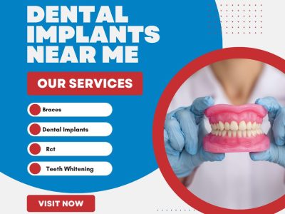 Full mouth dental implants near me for complete smile restoration