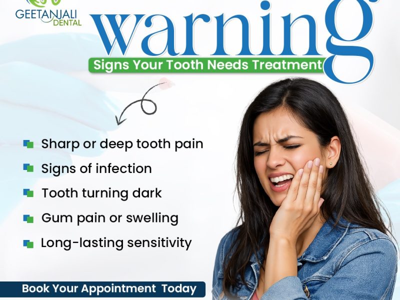 Root Canal Treatment in Gaur City for Safe Dental Care