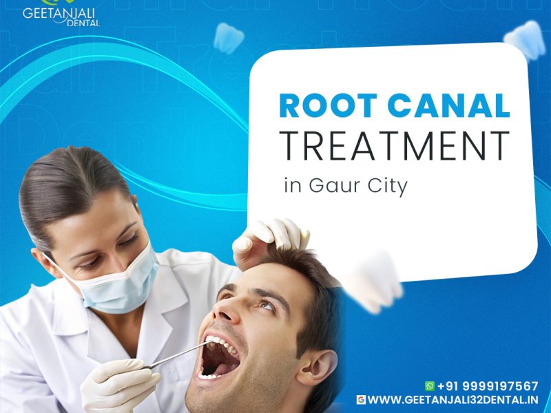 Root canal treatment in Gaur City for tooth protection