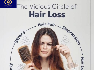 Effective Hair Loss Treatment in Thane with DNA Royal Experts.