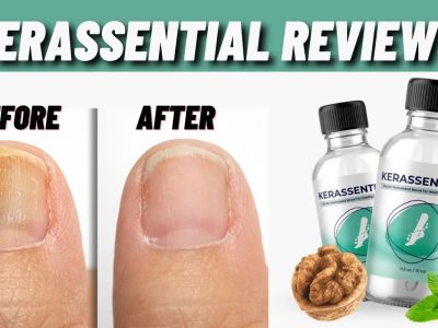 Kerassentials Toenail Fungus Oil Review – What to Know Before Use!
