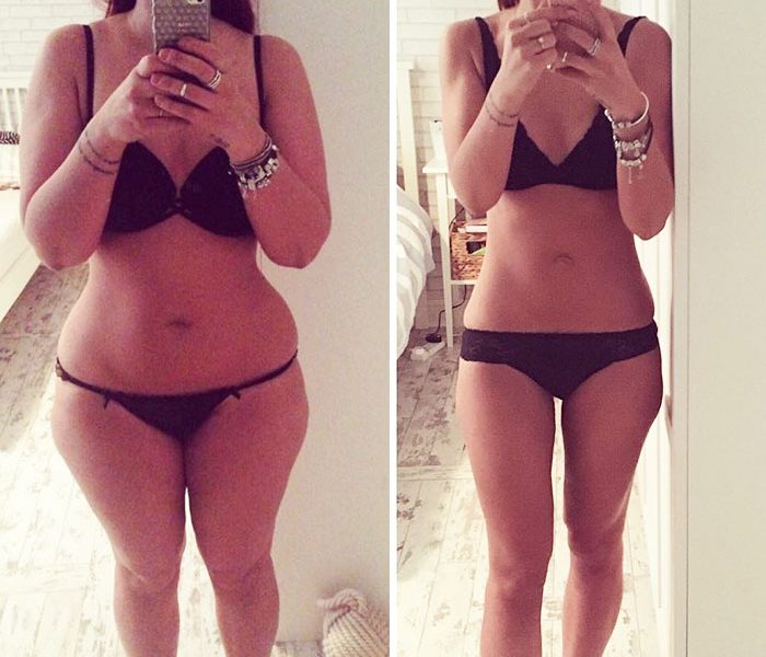 LipoLift Reviews – Does It Really Work? Honest Full Review