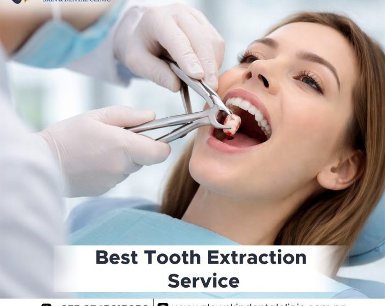 Best Tooth Extraction Service