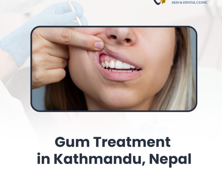 Gum Treatment in Kathmandu, Nepal