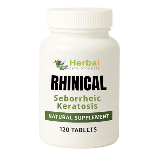 Natural Remedies for Seborrheic Keratosis