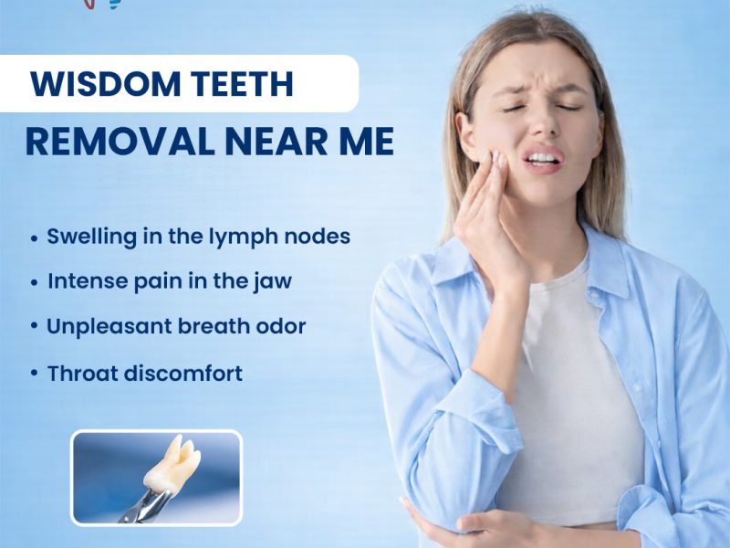 Wisdom Teeth Removal Near Me for Safe and Comfortable Treatment