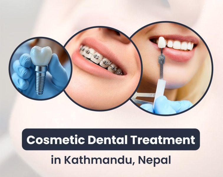 Cosmetic Dental Treatment in Kathmandu, Nepal