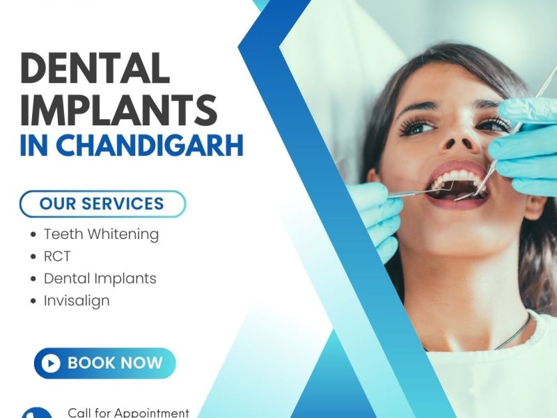 Dental Implants in Chandigarh – RK Dental Practice