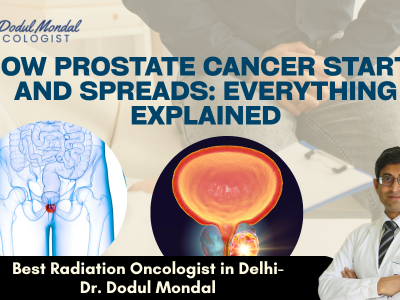 How Prostate Cancer Starts and Spreads: Everything Explained