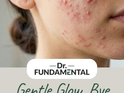 Gentle Glow, Bye Acne!