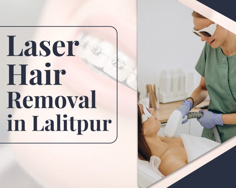 Best Laser Hair Removal in Lalitpur