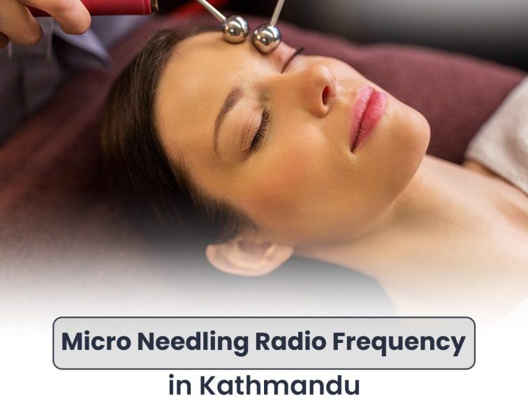Best Micro Needling Radio Frequency in Kathmandu
