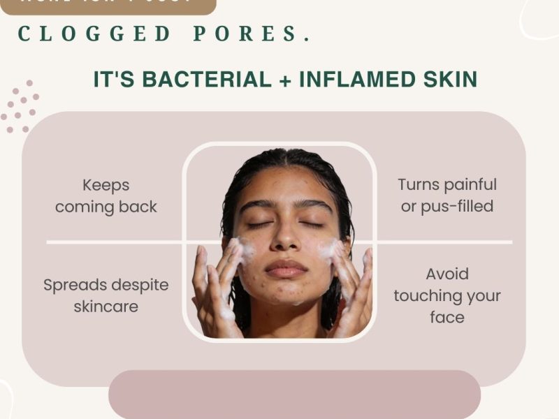 Best Gel Cleanser for Oily Skin | Gentle Acne Cleanser & Oil Control Face Wash