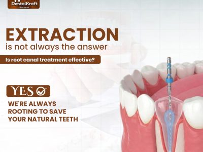 RCT Clinic in Indirapuram for Pain-Free Root Canal Treatment