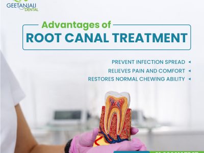 Root Canal Treatment in Gaur City for Safe Tooth Care
