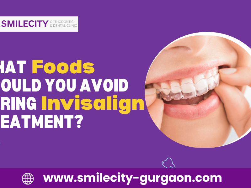 What Foods Should You Avoid During Invisalign Treatment?