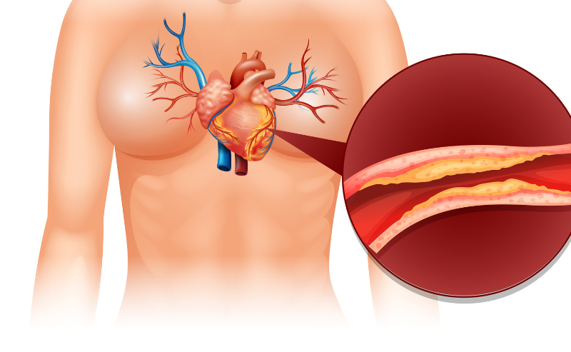 CT Coronary Angiography Price: Cost, Procedure, and What to Expect