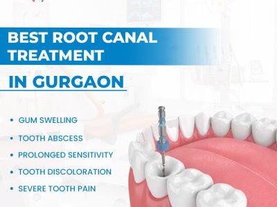 Best Root Canal Treatment in Gurgaon