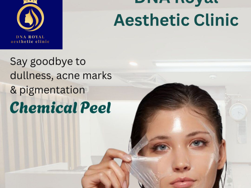 Safe & Effective Chemical Face Peel in Thane – DNA Royal.