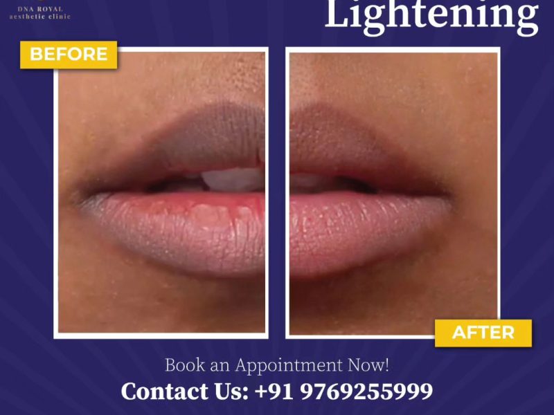 DNA Royal Thane Lip Blushing – Perfectly Tinted Lips That Last.