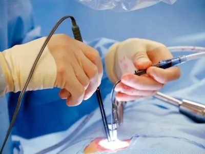 Best Hospital for Laser Surgery in Indirapuram - Namokarhospital